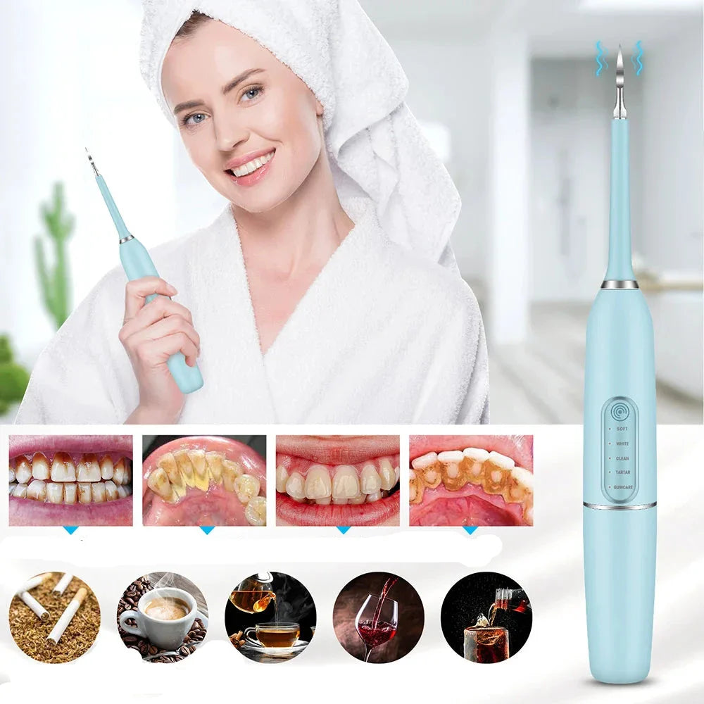 SparkleDent - Sonic Device for Tartar and Plaque Removal