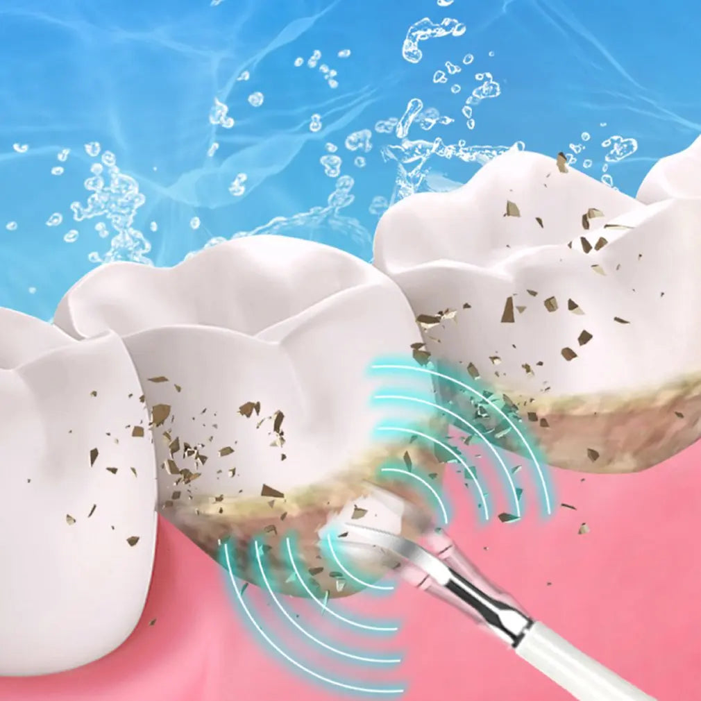 SparkSonic - Sonic Tooth Cleaner and Whitening Moisturizer