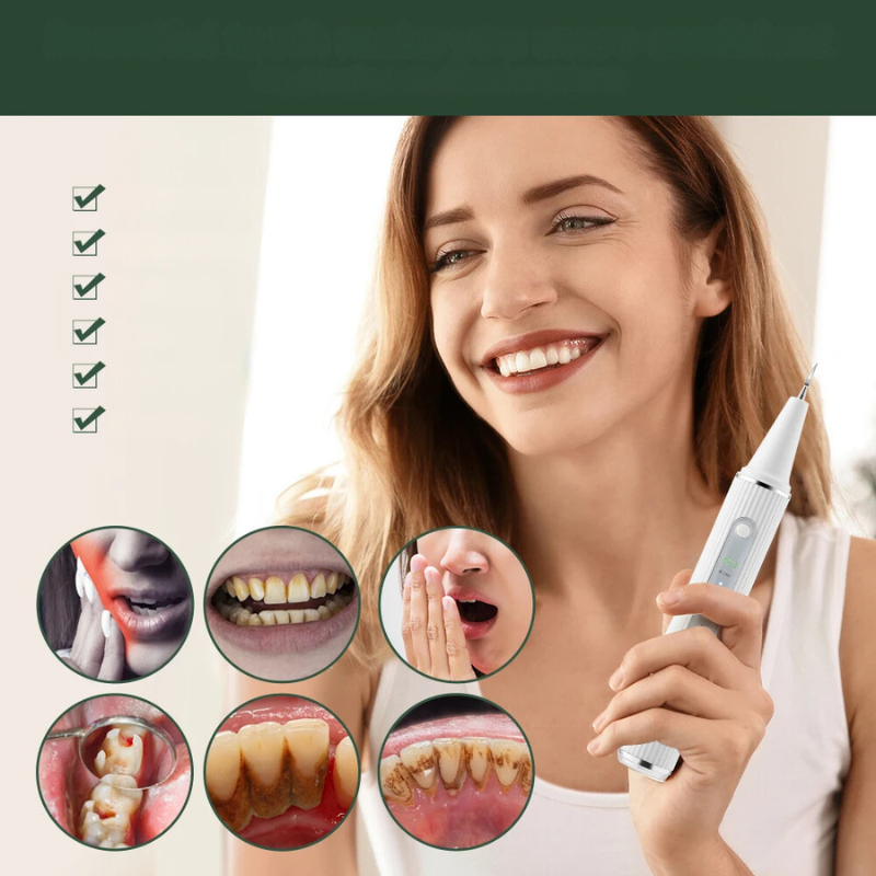 SparkleScan - Ultrasonic Dental Cleaner and Tartar Remover